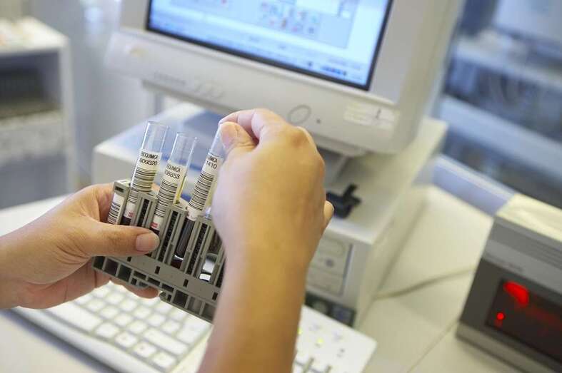 Muestras de laboratorio (Foto TA)